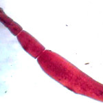 echinococcus
